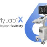 Esaote MyLab X6