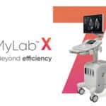 Esaote MyLab X7