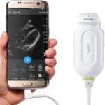 philips-lumify-2