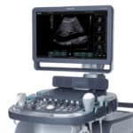 acuson_x600_ultrasound-01925629-10