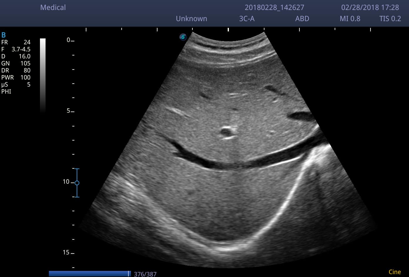 Ecógrafo portátil SonoScape E2 Doppler color - TMA MÉDICA