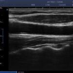 10.Carotid_1