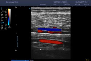 12.PTA&Peroneal A.__Color