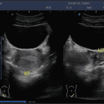 4. Uterus_2B